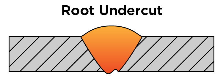 Root Undercut
